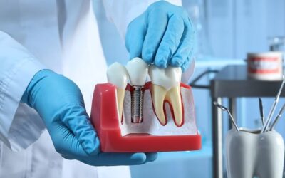 Rehabilitación dental: recupera tu sonrisa